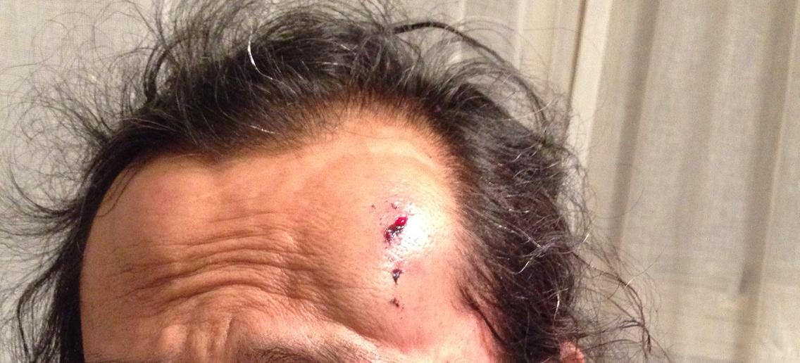 lee wen injury